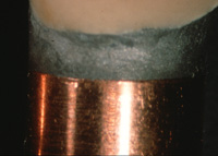 Dr doug erickosn uses a Spark Erosion Machine at Dental Implant and Reconstructive Center