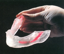 Stereolithography at Dental Implant and Reconstructive Centera