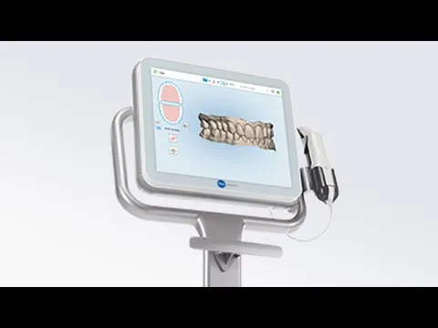 iTero scanner, advanced dental technology